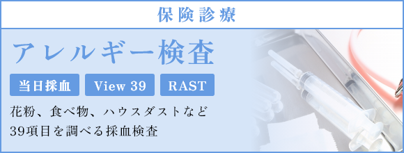 アレルギー検査 保険診療 当日採血 View39 RAST 花粉、食べ物、ハウスダストなど 39項目を調べる採血検査